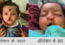 रायपुर : चिरायु योजना ने लौटाई मासूमों की मुस्कान…