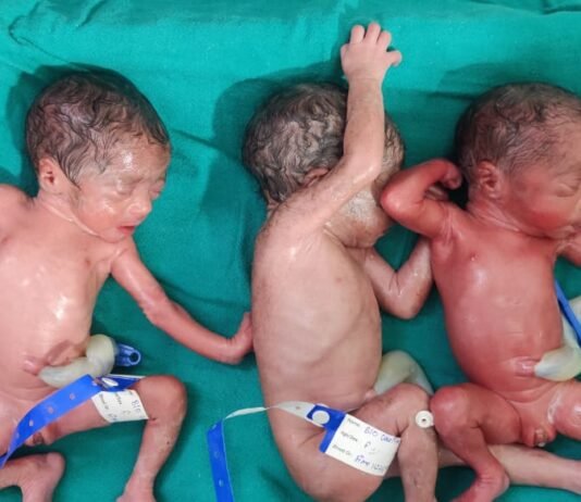 VISION TIMES: जिला अस्पताल में महिला ने एक साथ तीन बच्चियों को दिया जन्म…