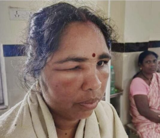 ब्रेकिंग न्यूज़: राजनांदगांव में मधुमक्खियों का हमला, दो लोगों की मौत, कई घायल…